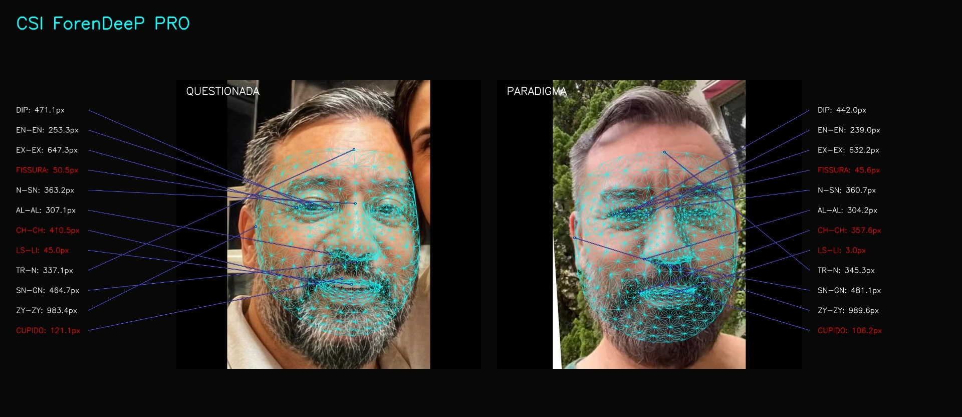 Prancha de Confronto Pericial